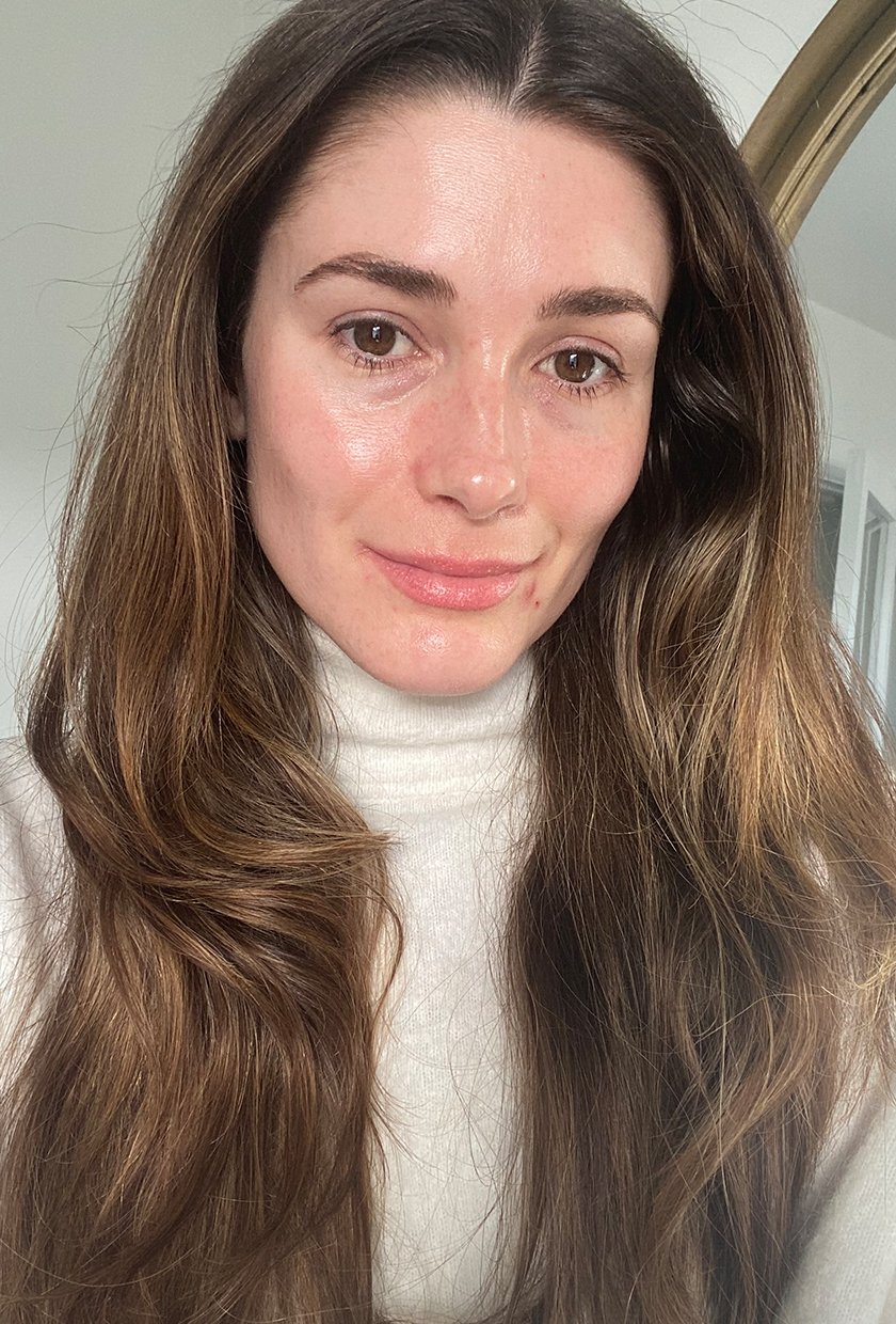 Eleanor after using the Dermalux LED Mask