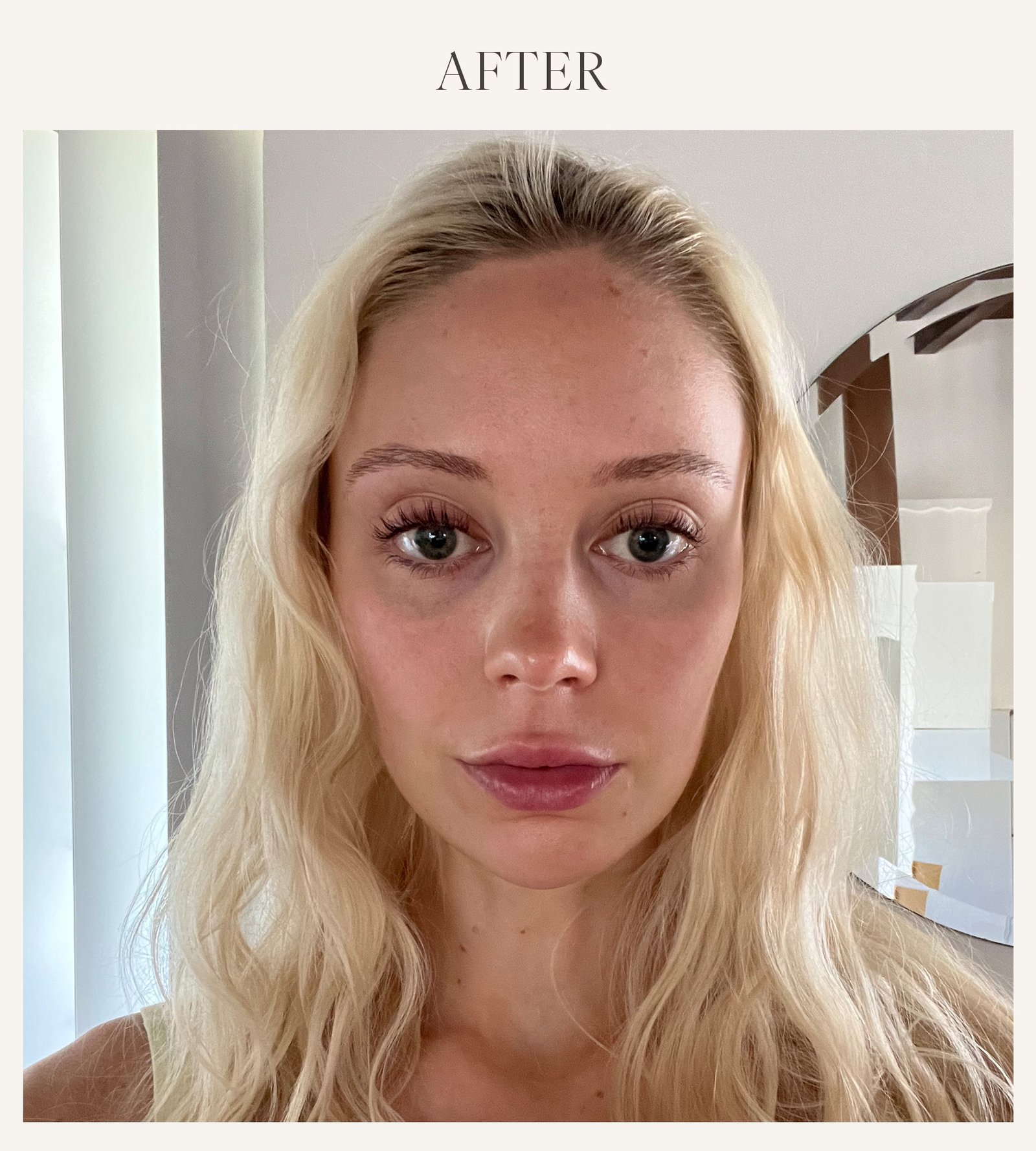 After photo of Erin Jahns testing the KNC lip plumping mask