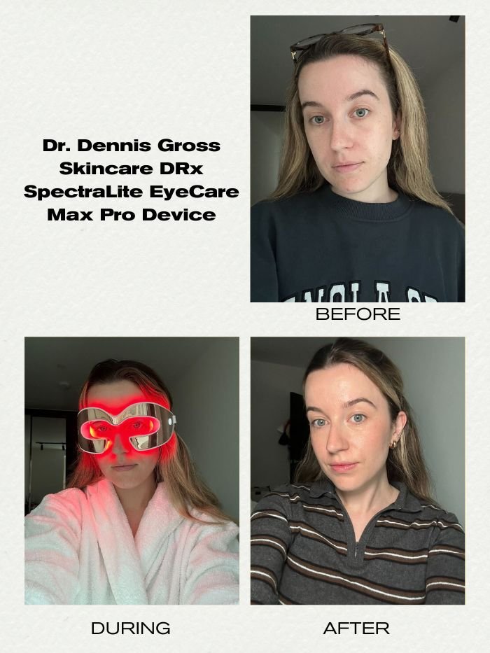 grace lindsay before and after using an LED eye mask