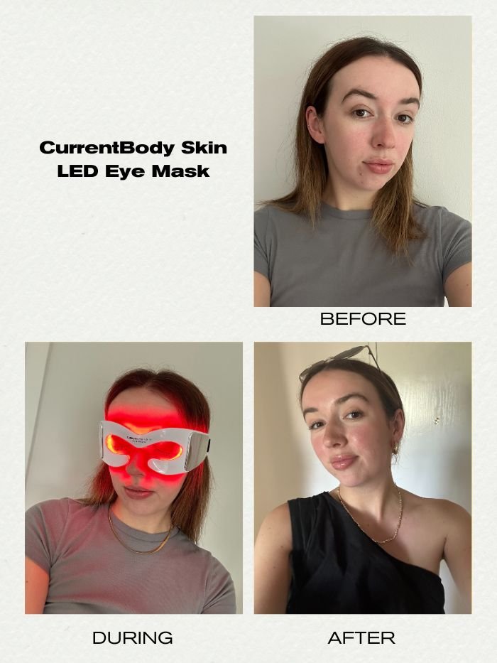 megan storey before and after using an LED eye mask